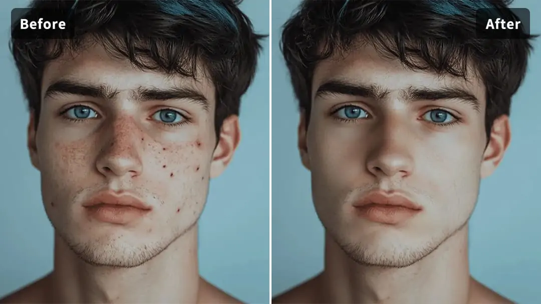 AI automatically identifies and helps you remove facial blemishes with one click AI automatically identifies and helps you remove facial blemishes with one click