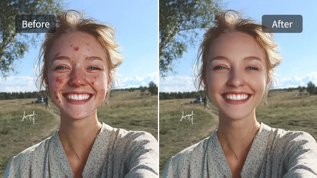 Comparison photo with facial blemishes removed