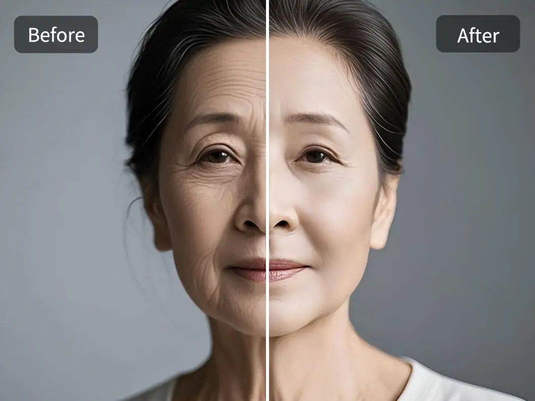一鍵去除臉上的皺紋