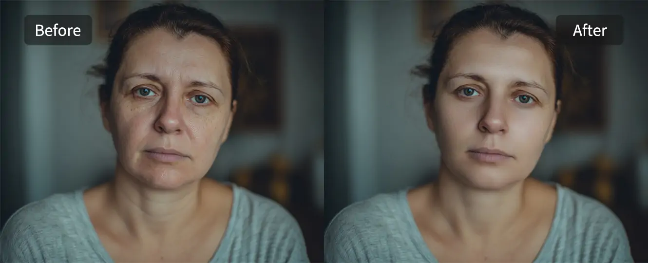 Left and right comparison of removing facial blemishes