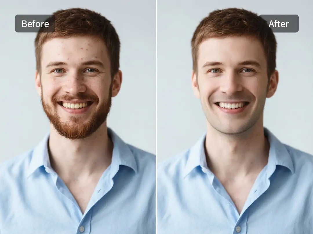 Remove any blemishes on the face