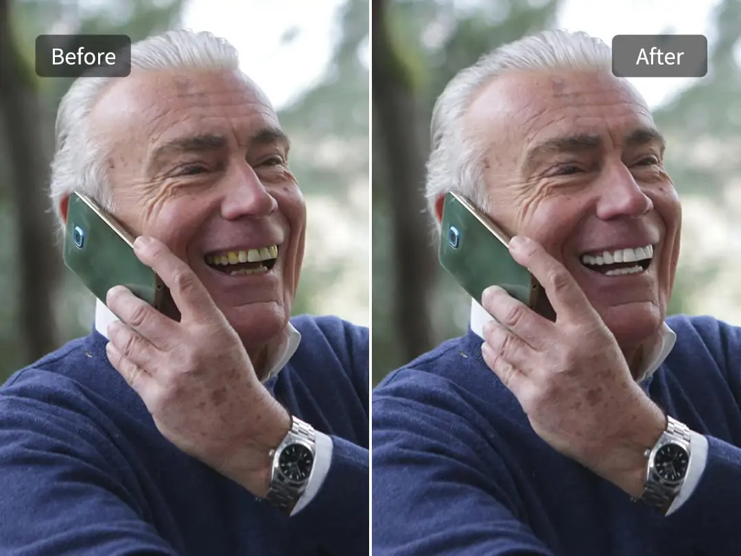 Whiten teeth for old people online